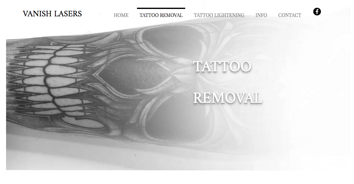 Vanish Lasers' Homepage