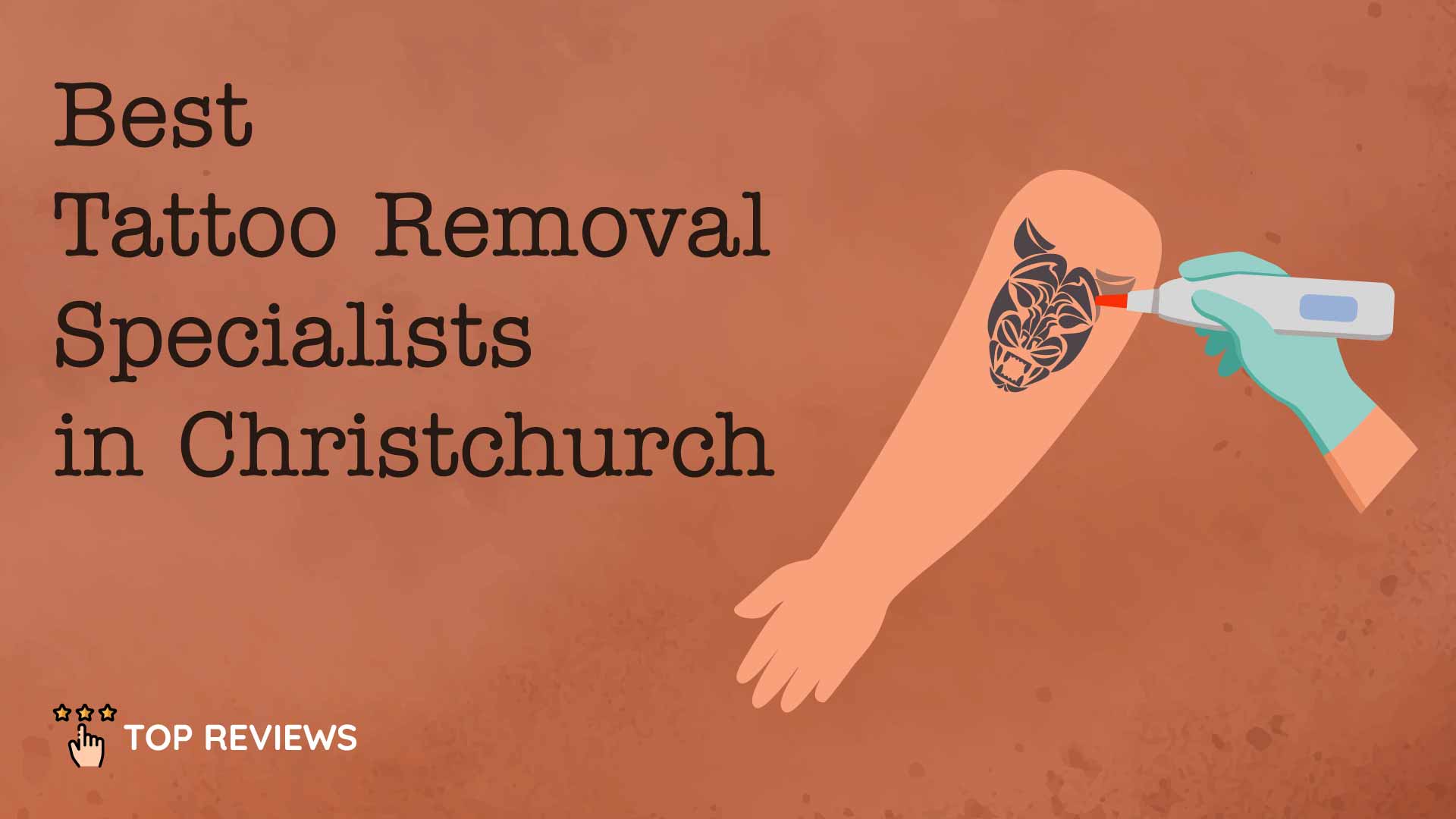 ▷ Laser Tattoo Removal, Christchurch