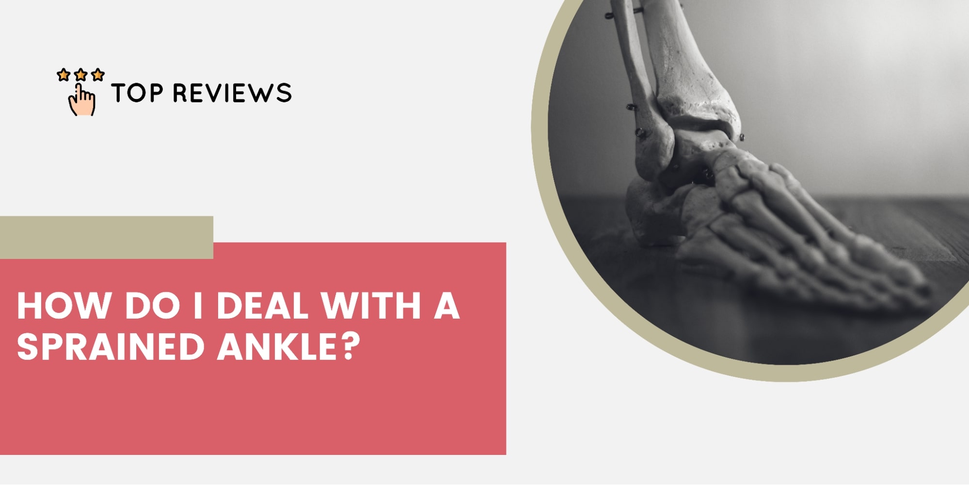 How do I deal with a sprained ankle
